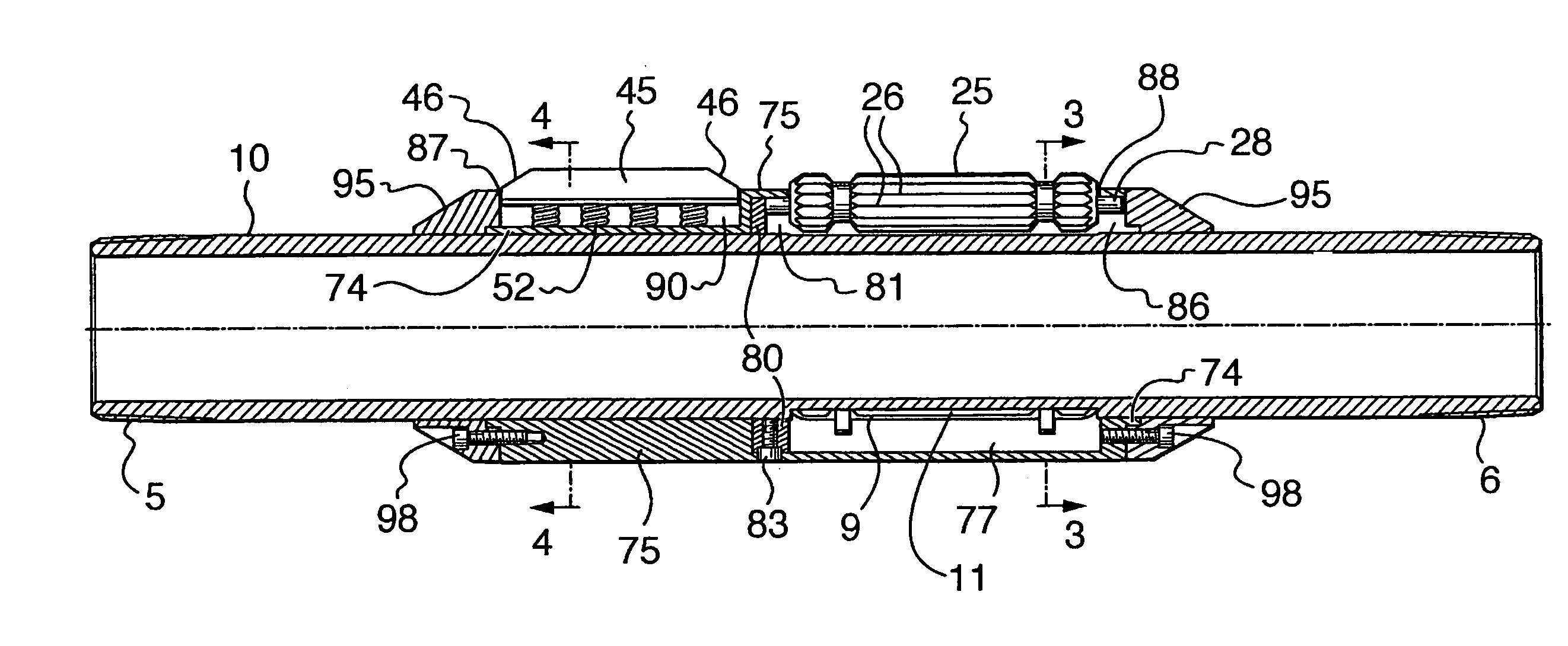 Torque anchor