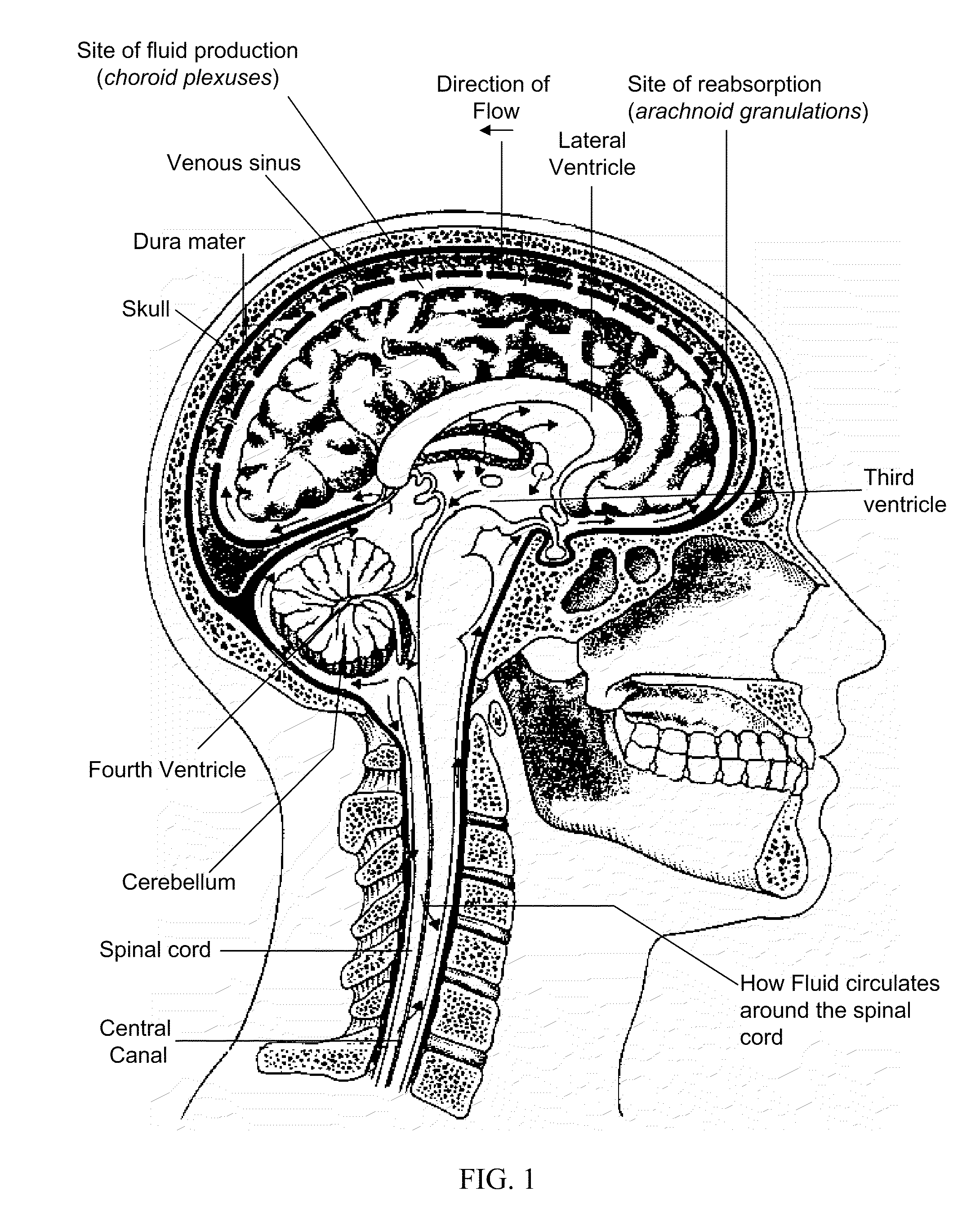Methods and compositions for treating pain