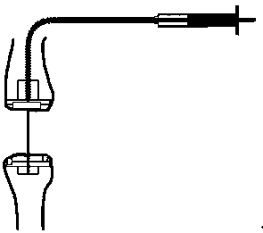 Esophageal extension and anastomat capable of being accurately controlled in vitro