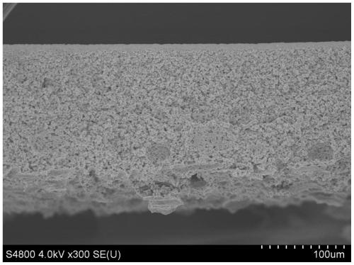 Polymer microporous membrane and preparation method thereof, and water treatment equipment