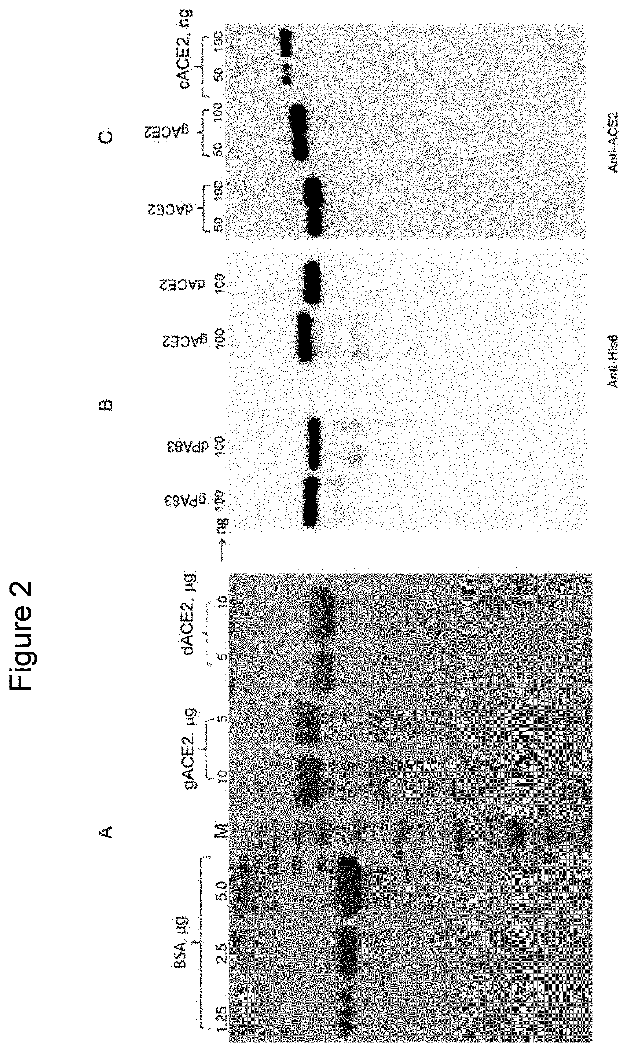 Engineering, production and characterization of plant produced, soluble human angiotensin converting enzyme-2 as a therapeutic target in covid-19