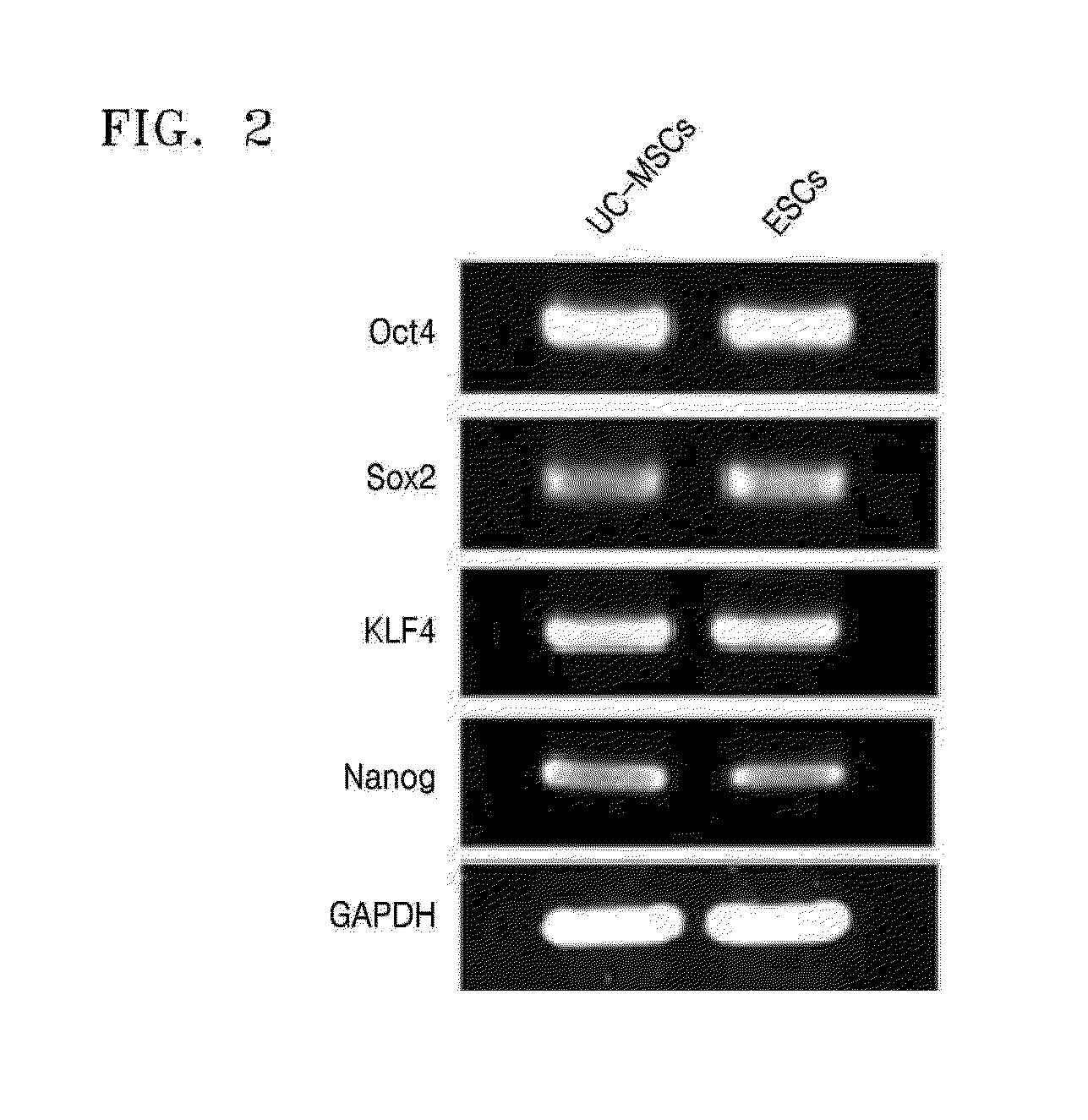 Cartilage cell treatment comprising collagen, hyaluronic acid derivative, and stem cell derived from mammal umbilical cord