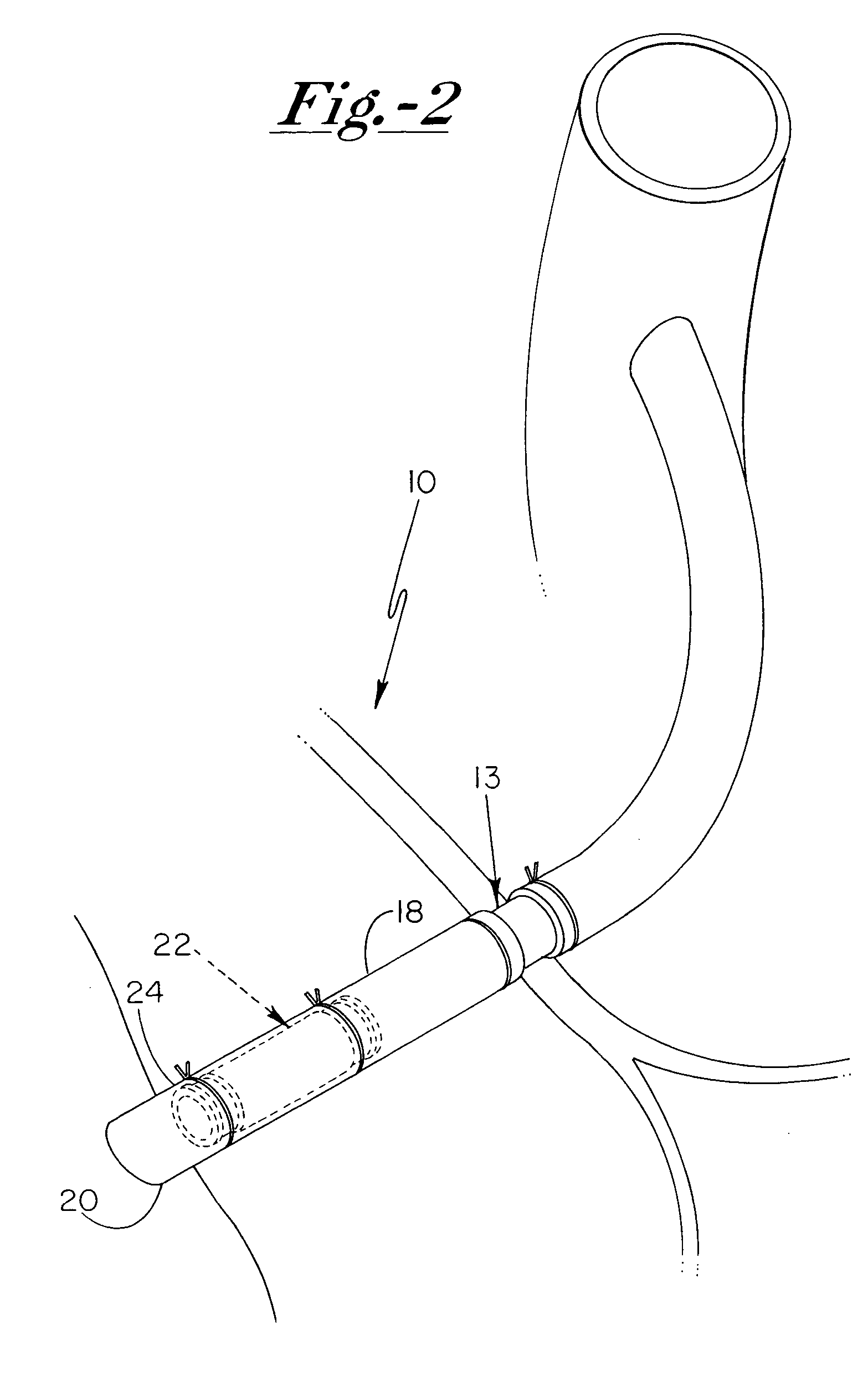 Grafted network incorporating a multiple channel fluid flow connector