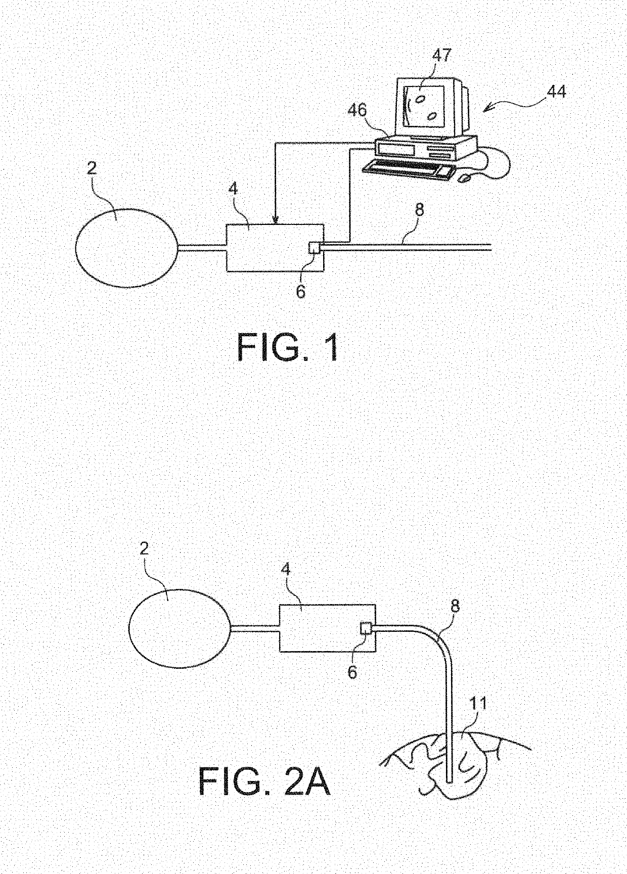 Closed loop system for controlling the reflux of a fluid injection