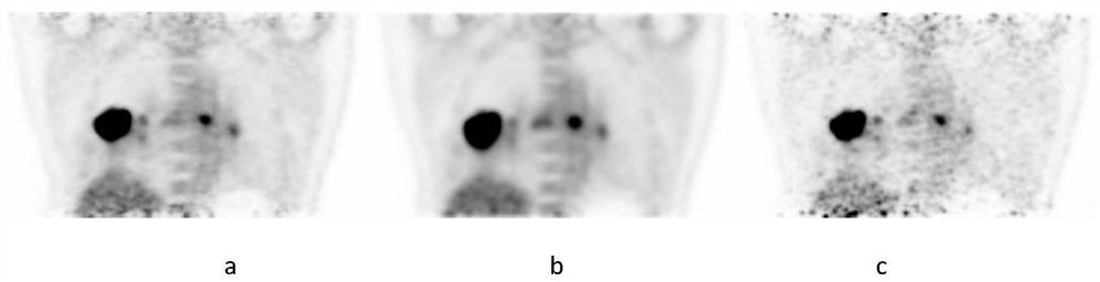 Correction information acquisition method for performing attenuation correction on PET images of breath or heart