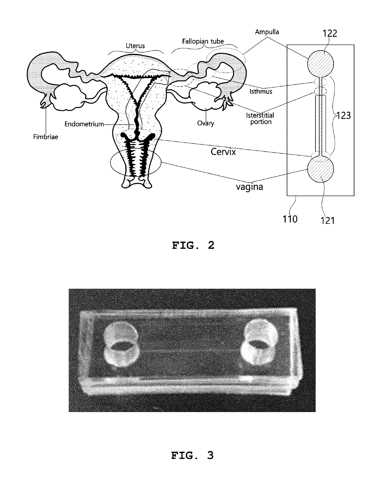 Microchip mimicking female reproductive organs and method for fabricating the same