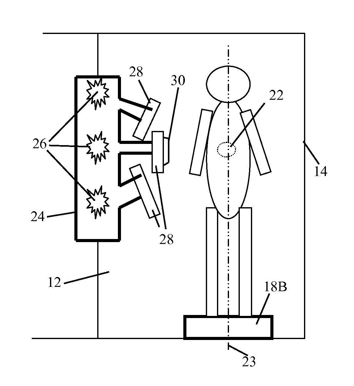 External beam radiation therapy for a plurality of compartments