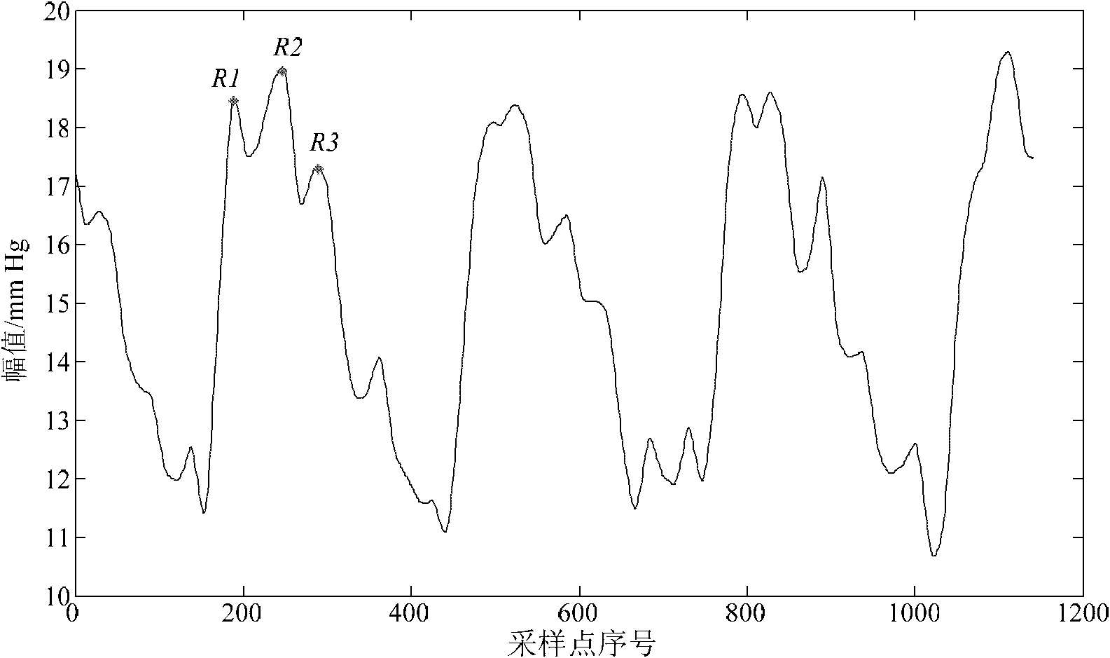 A method for identifying characteristic peaks of intracranial pressure signals