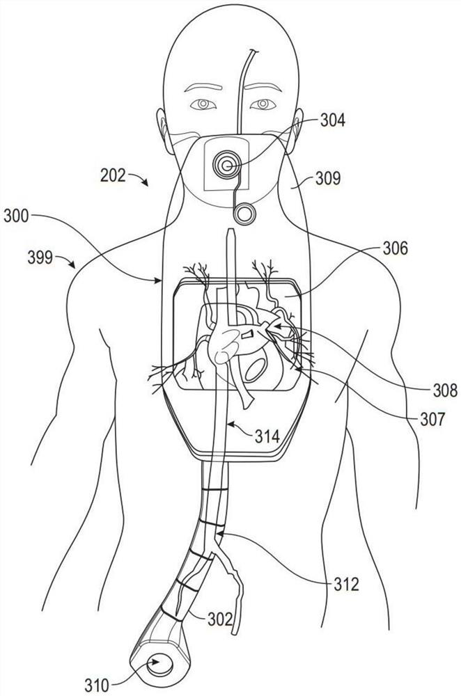 Patient-specific cardiovascular simulation device