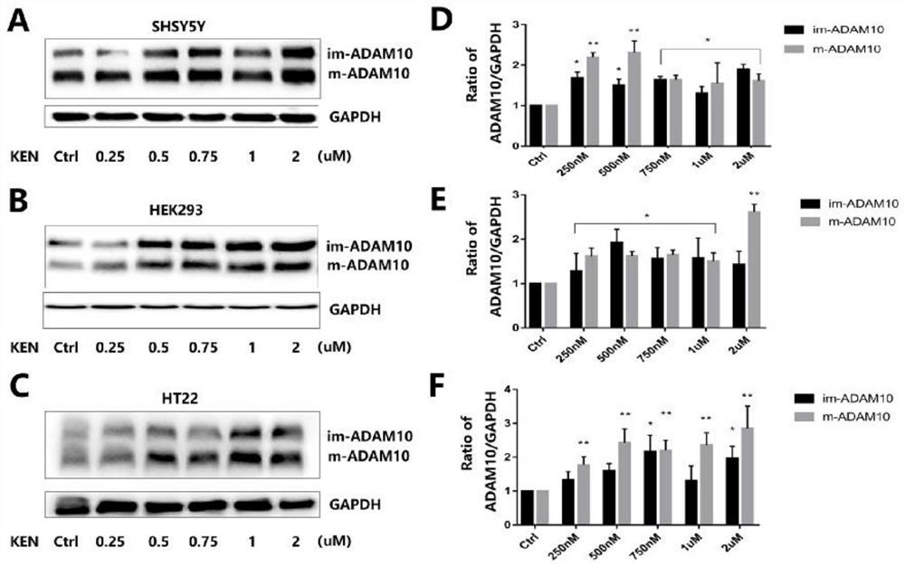 Application of Kenpaullone in preparation of medicine capable of preventing or treating cerebral amyloid angiopathy