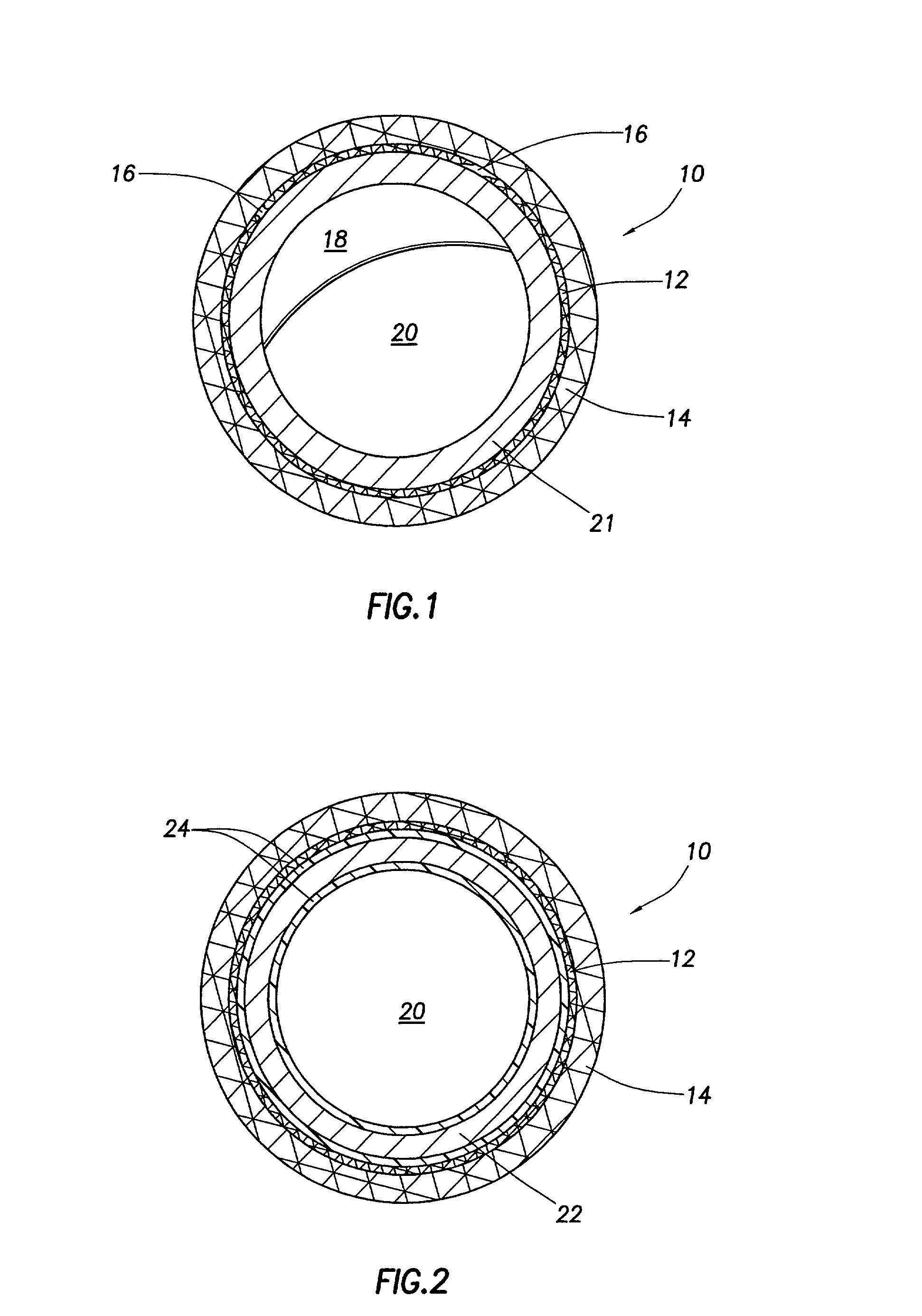 Stent coatings containing HMG-CoA reductase inhibitors
