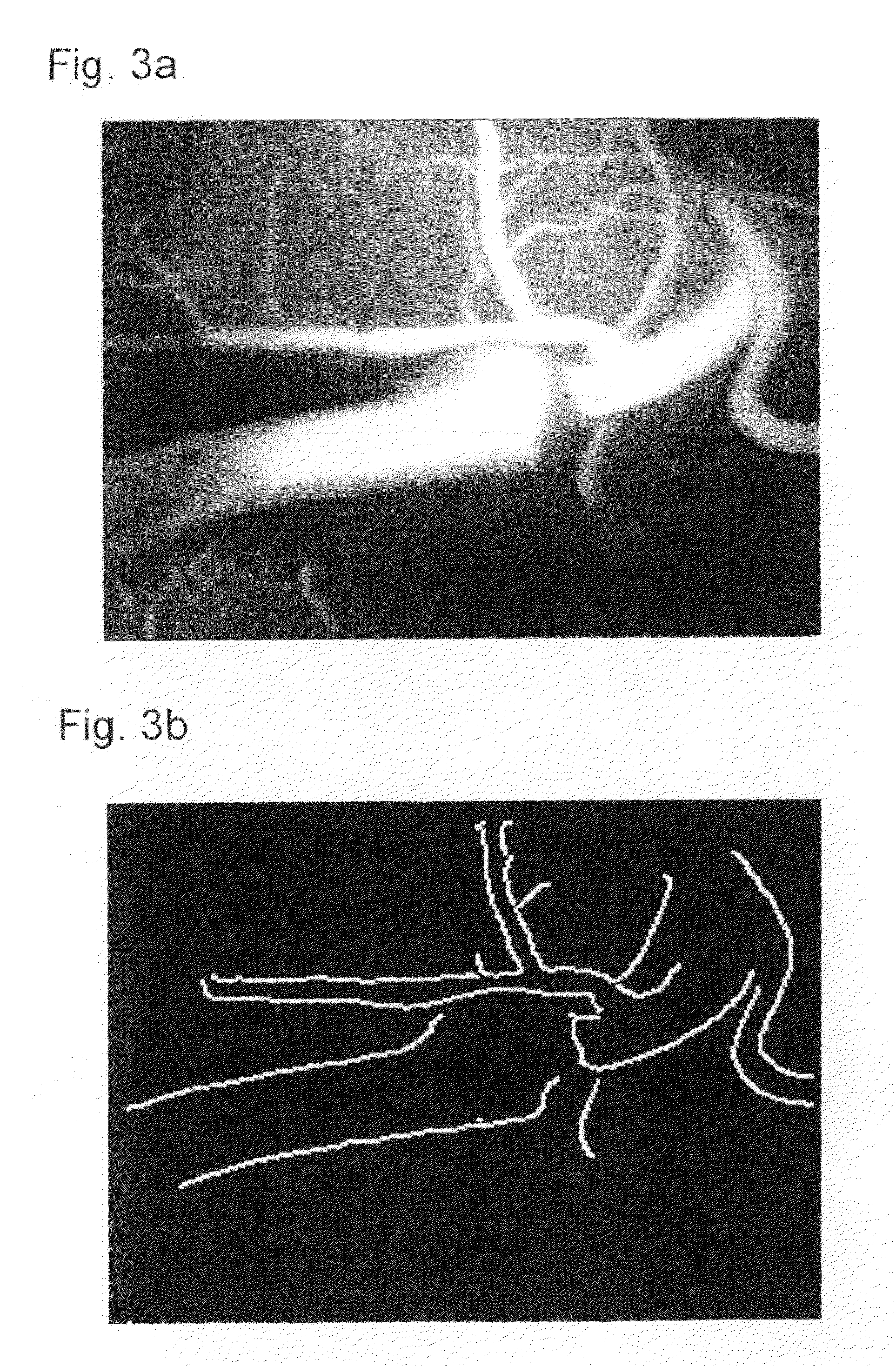 Method for correcting the image data that represent the blood flow