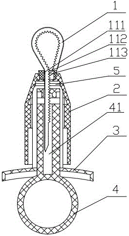 Umbilical cord binding device