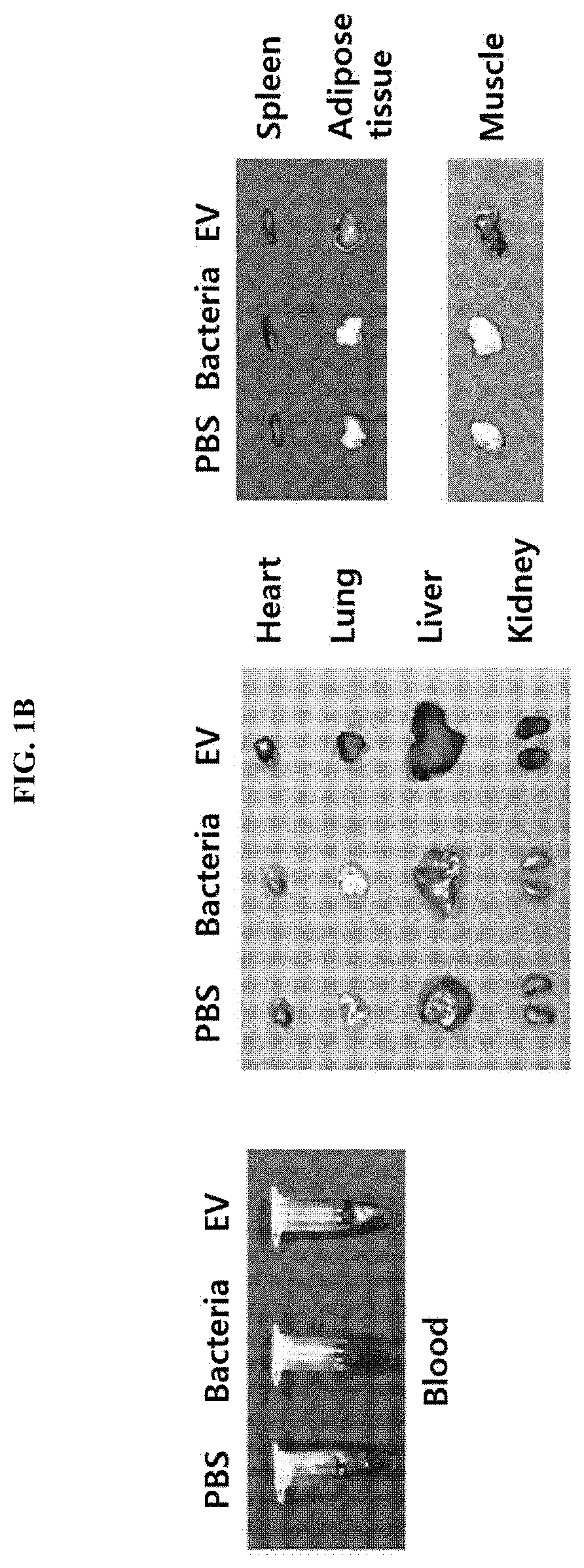 Nanovesicles derived from bacteria of genus rhodococcus, and use thereof