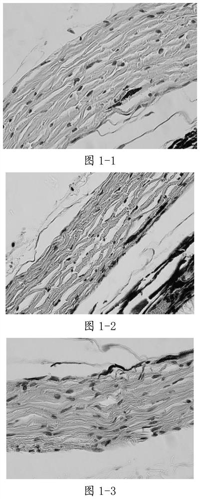 Traditional Chinese medicine composition for relieving myopia and application thereof