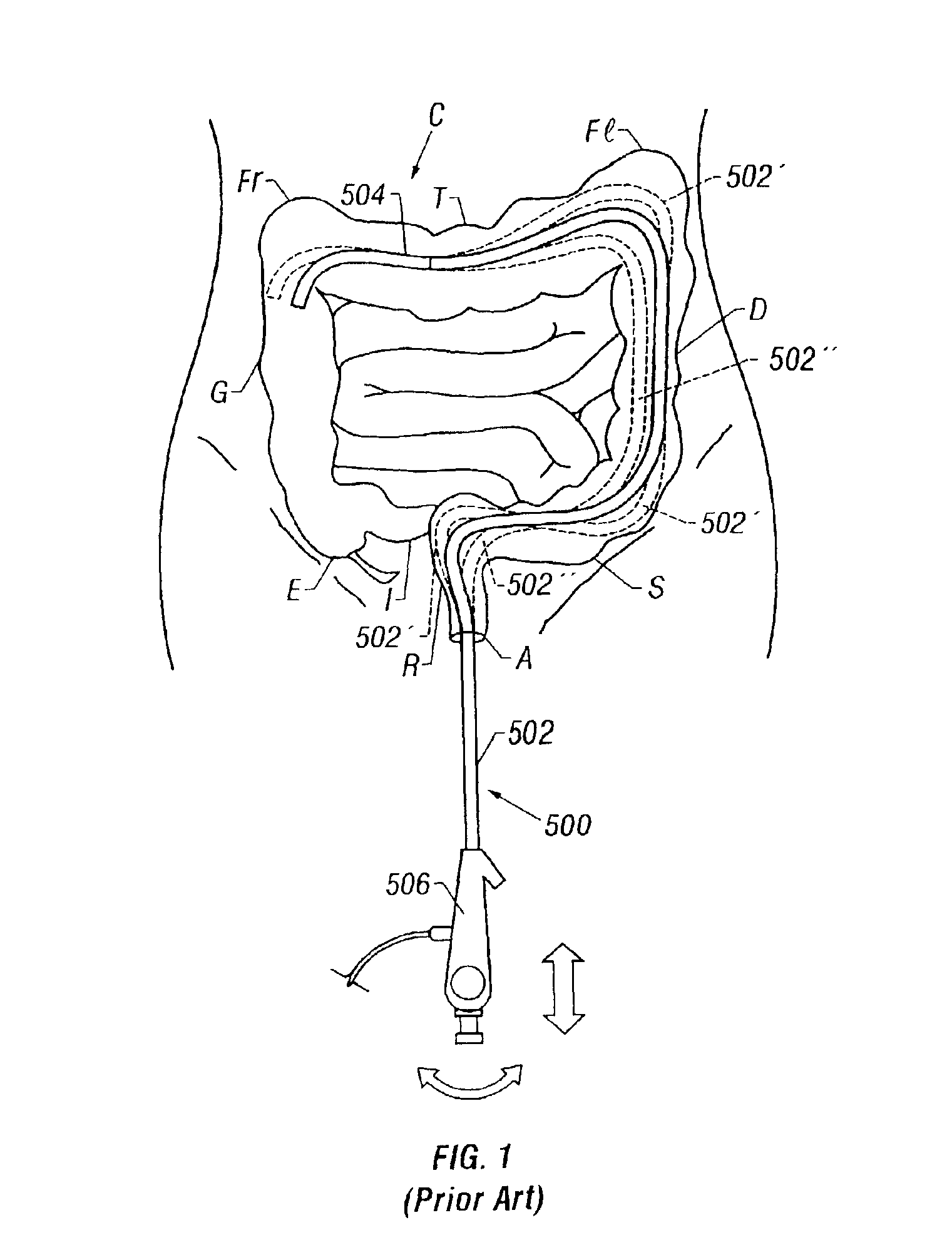 Steerable endoscope and improved method of insertion