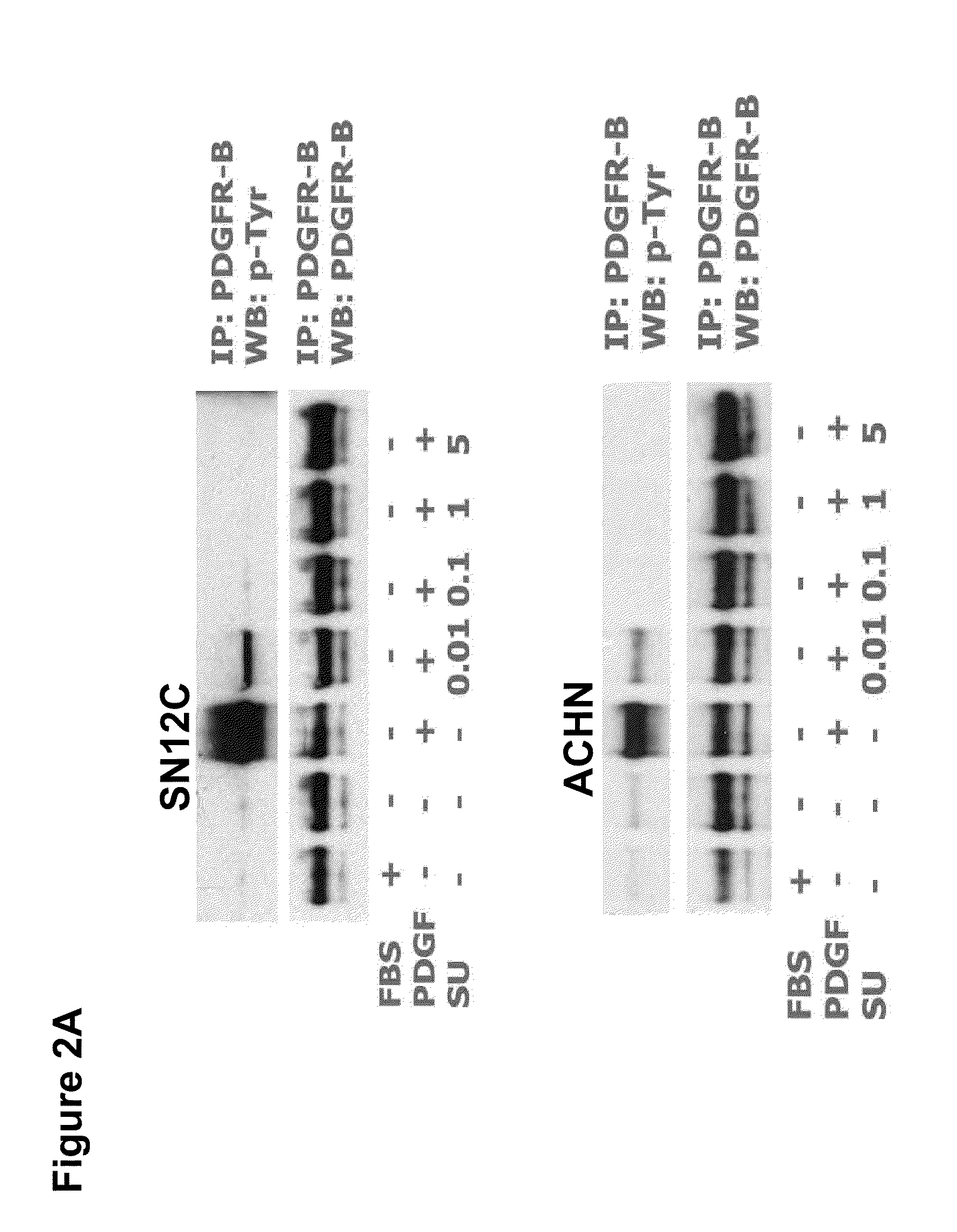 Methods for treating sunitinib-resistant carcinoma and related biomarkers