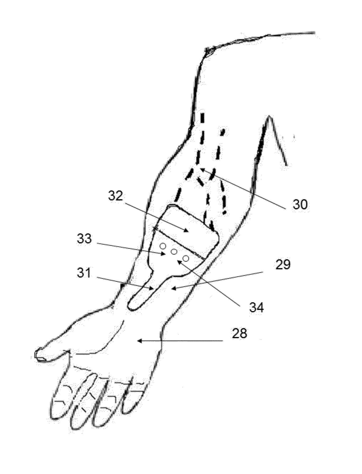 Device, system and method for blood vessel imaging and marking