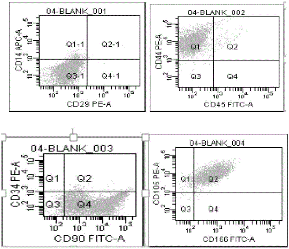 MiRNA145-5p-modified umbilical cord mesenchymal stem cell exosome and preparation and application of miRNA145-5p-modified umbilical cord mesenchymal stem cell exosome