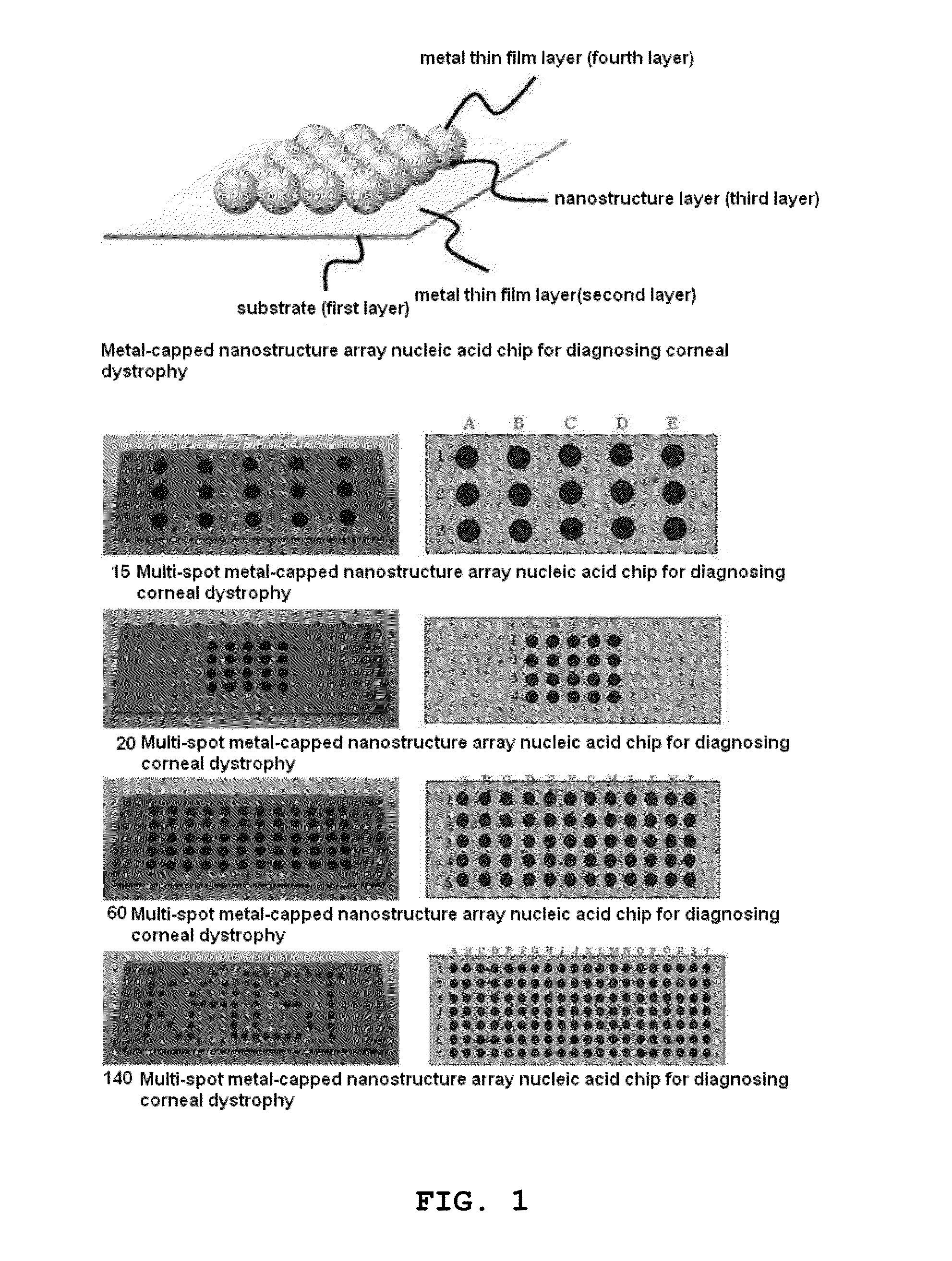 Multi-spot metal-capped nanostructure array nucleic acid chip for diagnosing of corneal dystrophy and preparation method thereof producing same