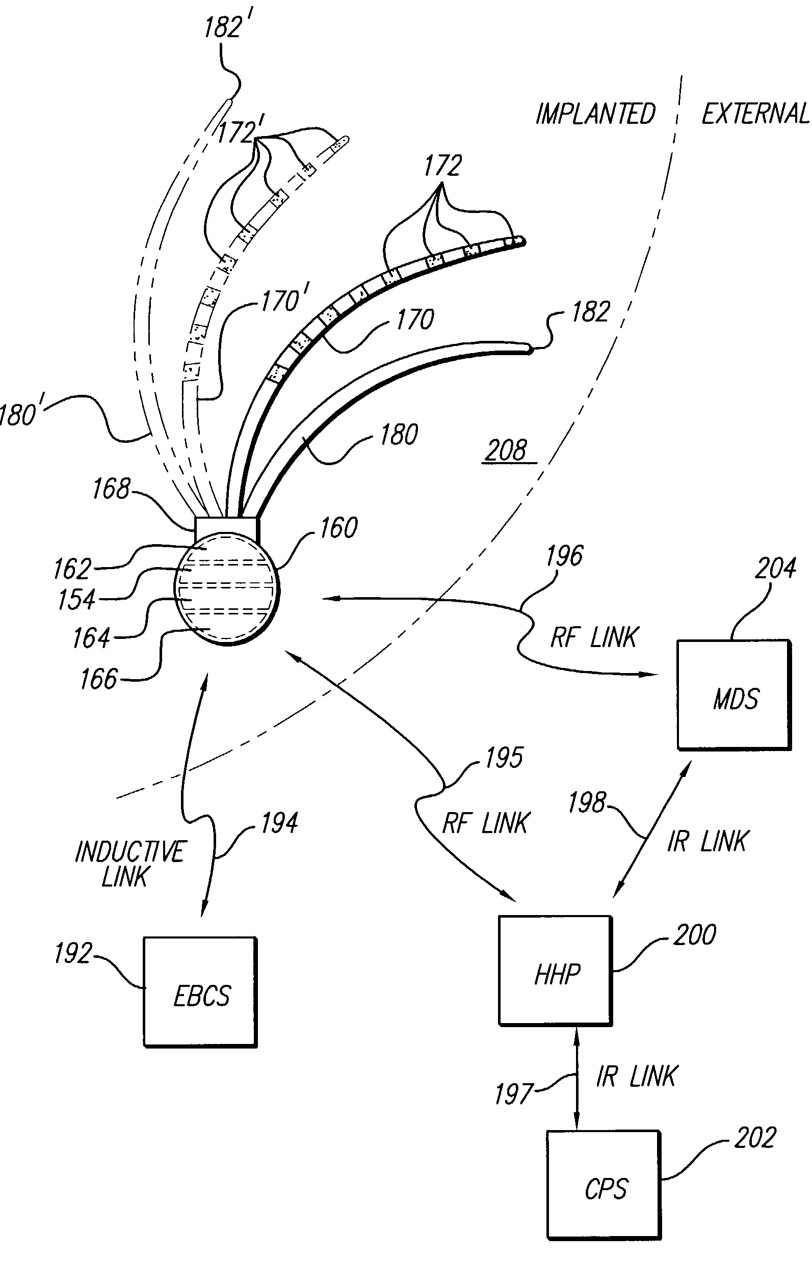 Systems and methods for treatment of coronary artery disease