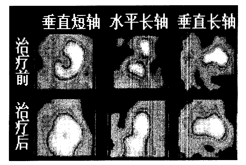 Biologic degradable magnesium alloy medicine supporter for reconstructing blood circulation and preparation method