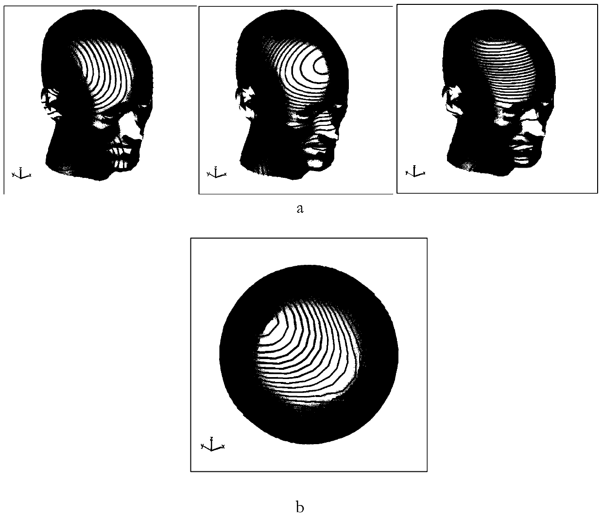 A gradient coil design method for a biomedical imaging system and a gradient coil