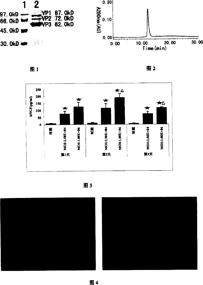 Adeno-associated virus vector preparation and medicinal composition containing it and its use