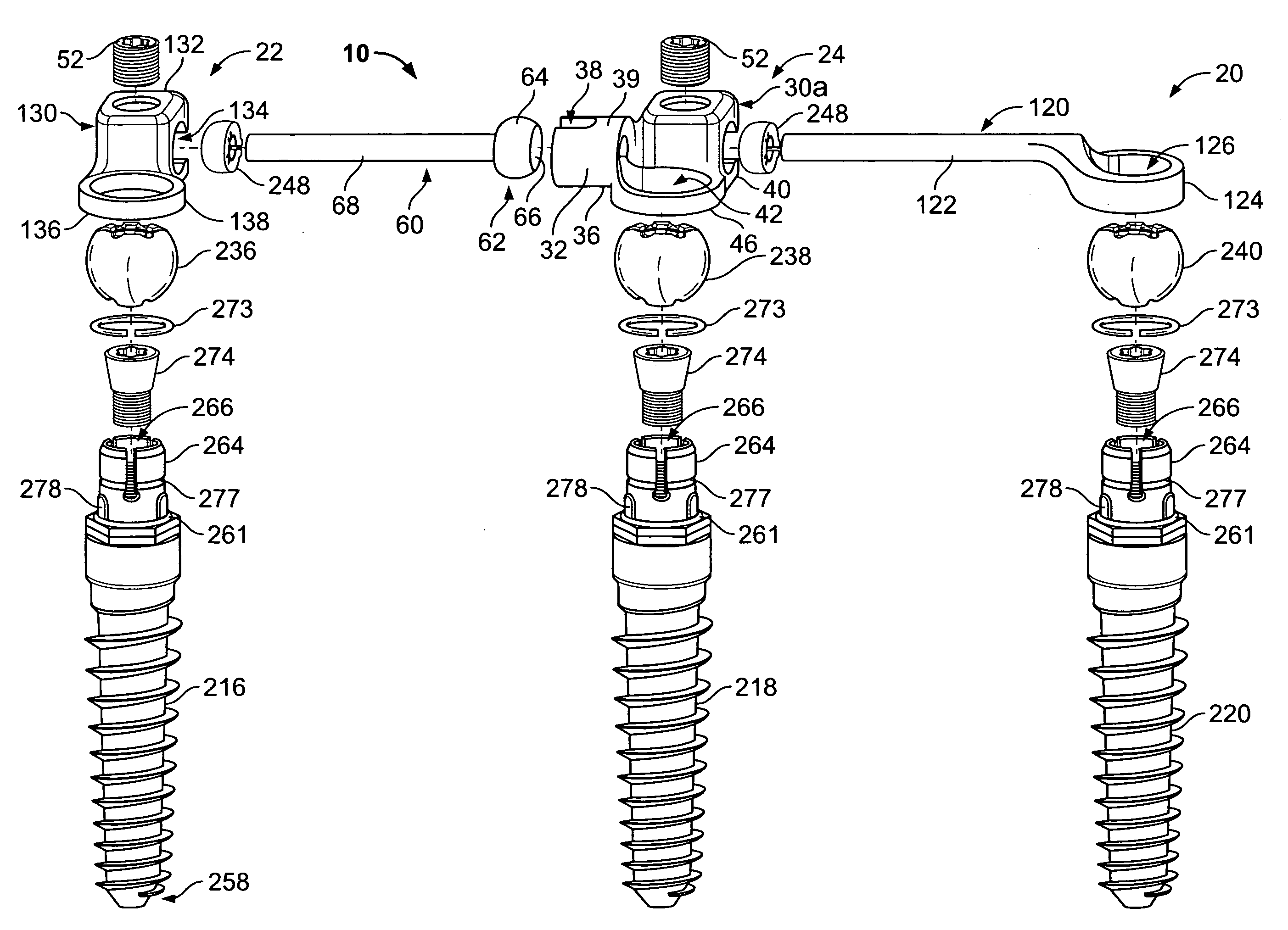 Multi-level spinal stabilization system