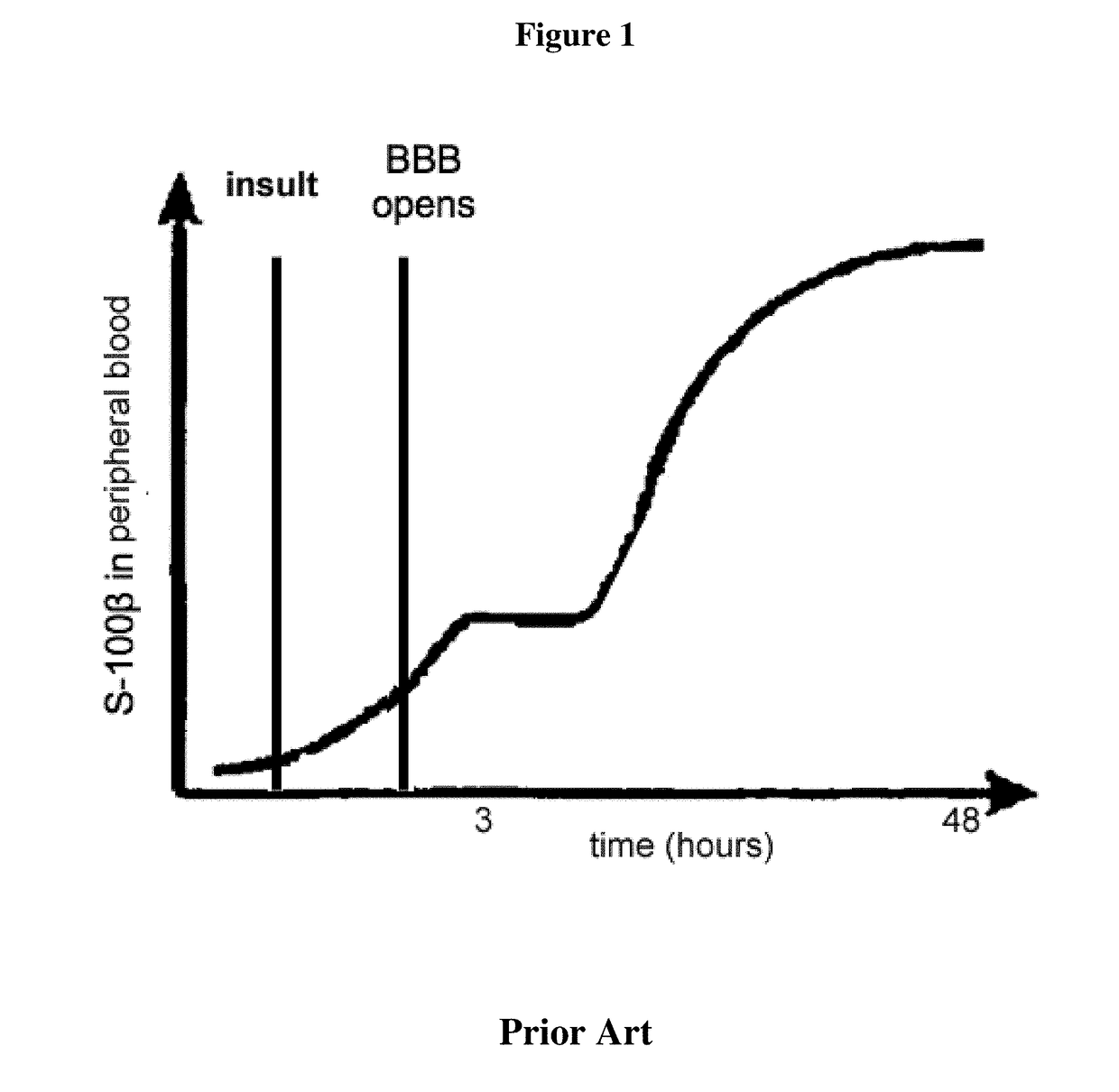 Diagnostic marker for treatment of cerebral ischemia