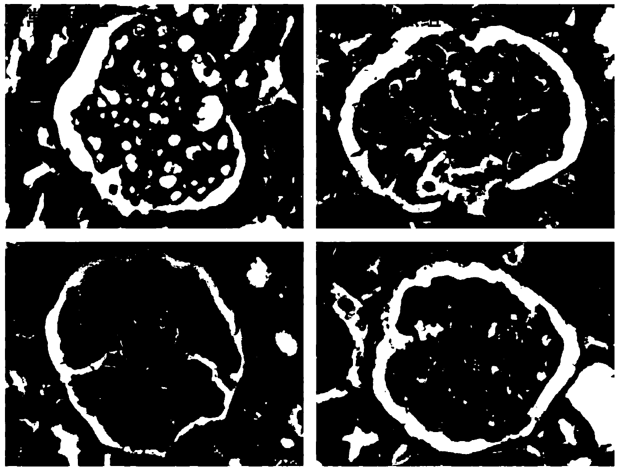 Application of dendrophenol in preparing medicines for preventing and treating chronic glomerular disease