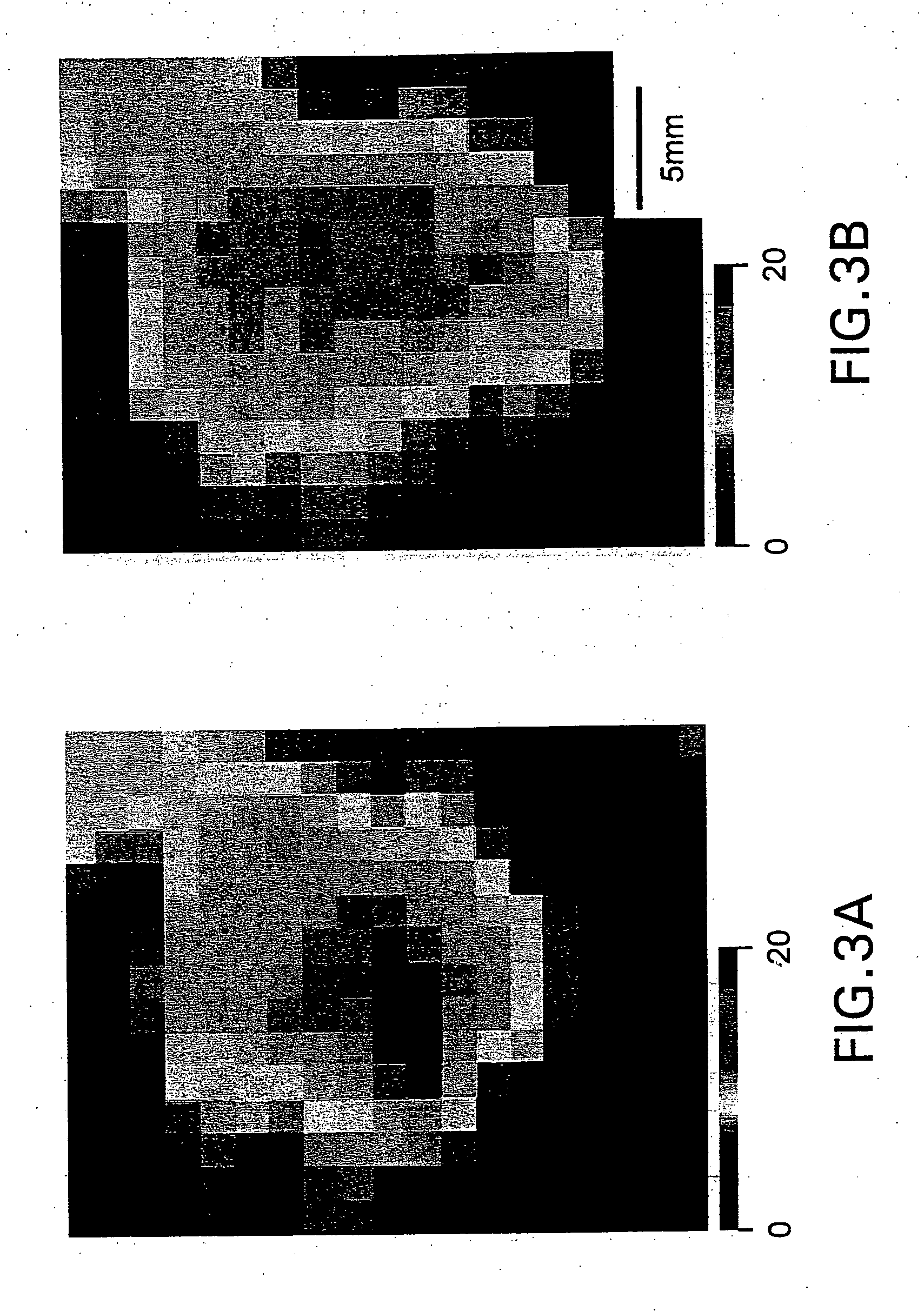 Method and apparatus for quantitatively evaluating a kidney