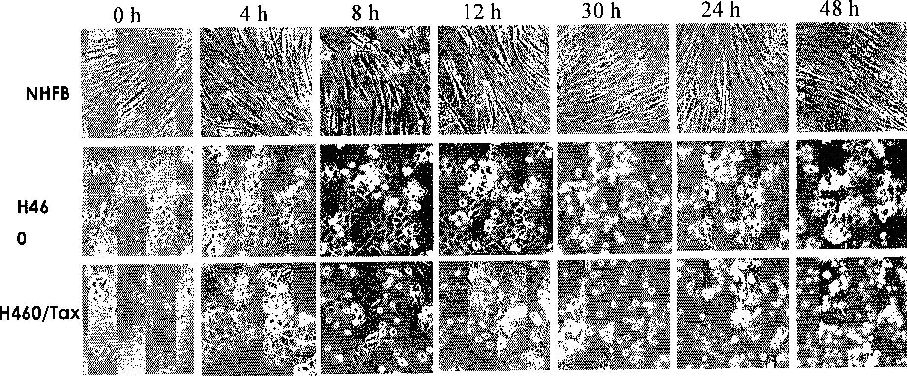 Thiazolidone derivates and application thereof in preparing anti-lung cancer medicine