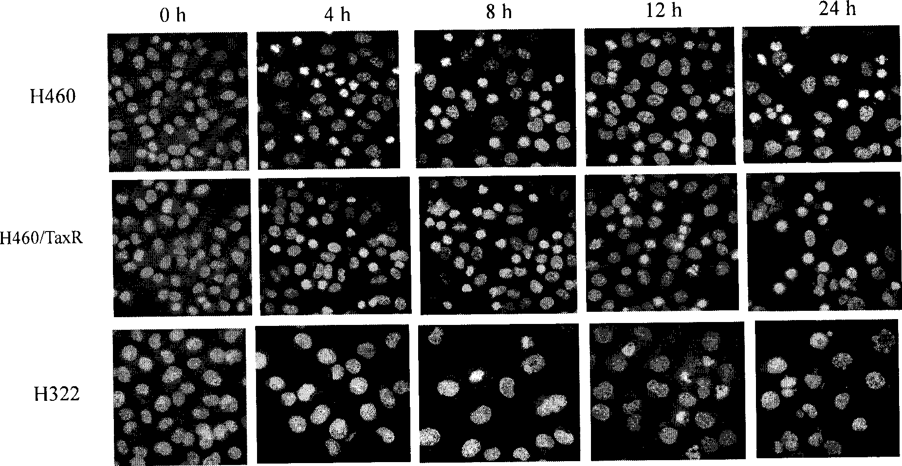 Thiazolidone derivates and application thereof in preparing anti-lung cancer medicine