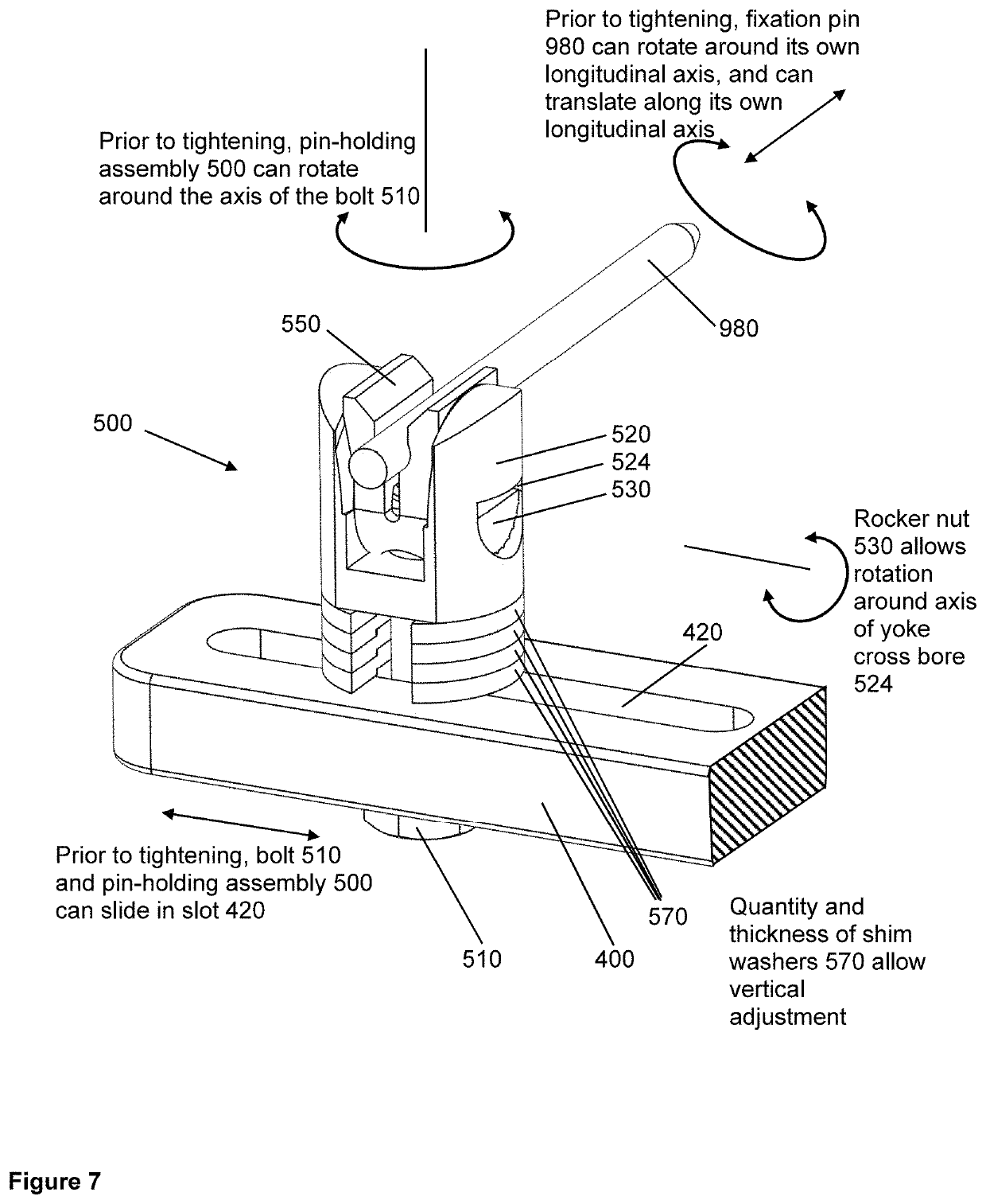 Y-Frame External Bone Fixator