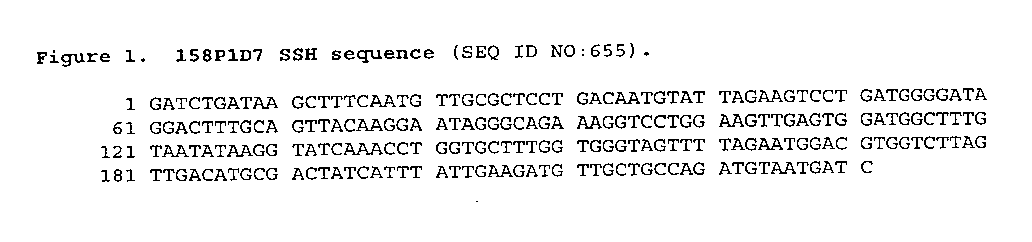 Nucleic acid and corresponding protein named 158P1D7 useful in the treatment and detection of bladder and other cancers