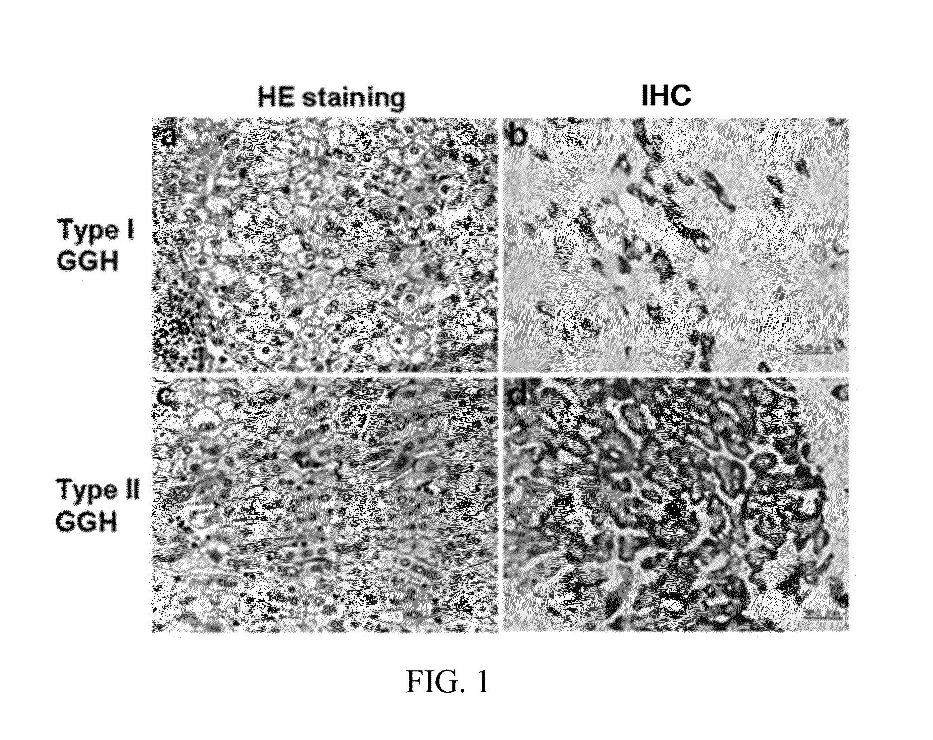 Antibodies and method for determining deletions in HBV pre-s2 region