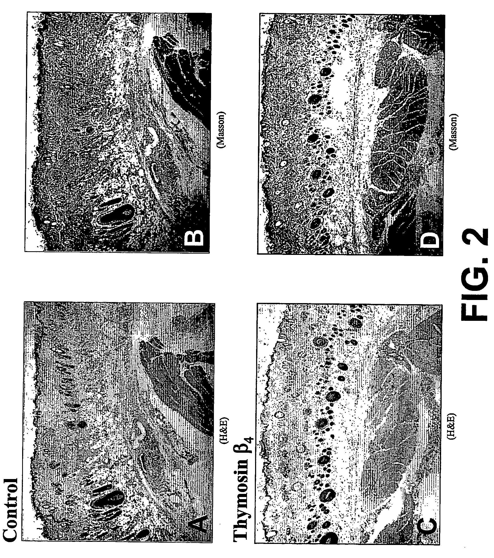 Methods and compositions for the promotion of a hair growth utilizing actin binding peptides