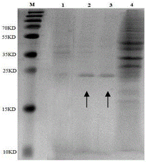 Gene and method for preparing recombinant fugu rubripes IFN-gamma protein
