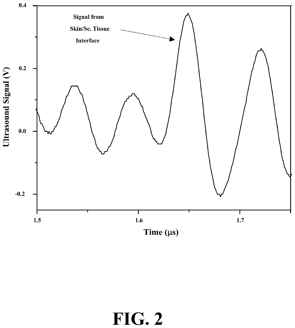 Wearable, Noninvasive Monitors Of Glucose, Vital Sign Sensing, And Other Important Variables And Methods For Using Same