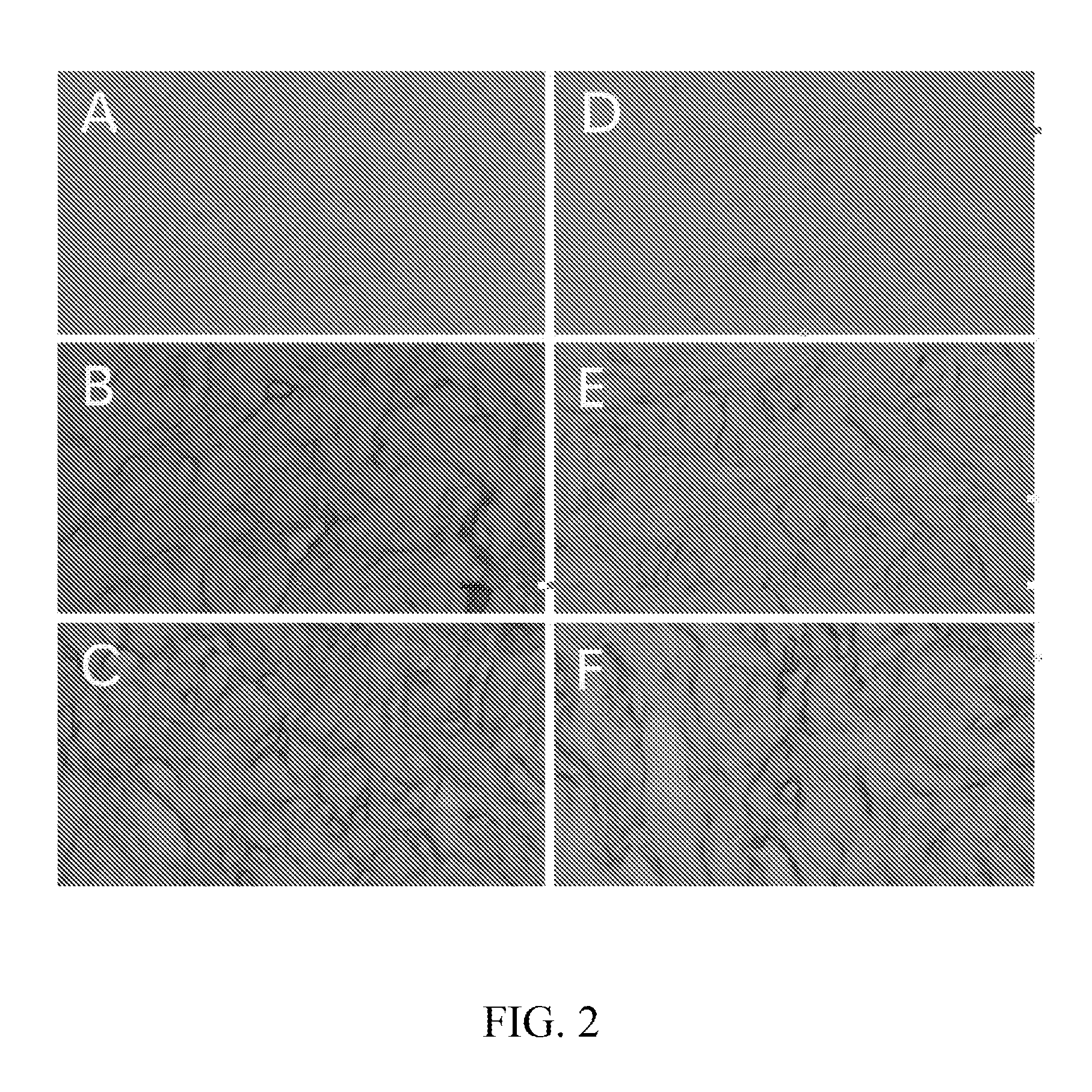 Method for preparing an animal decellularized tissue matrix material and a decellularized tissue matrix material prepared thereby