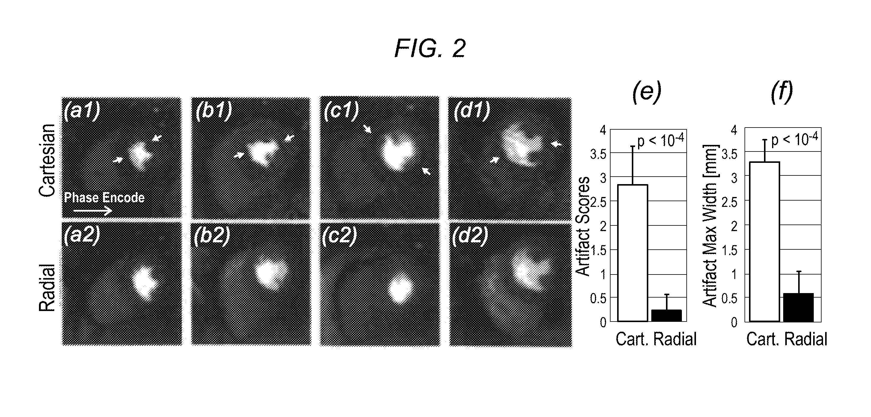 Systems and methods for myocardial perfusion MRI without the need for ECG gating and additional systems and methods for improved cardiac imaging