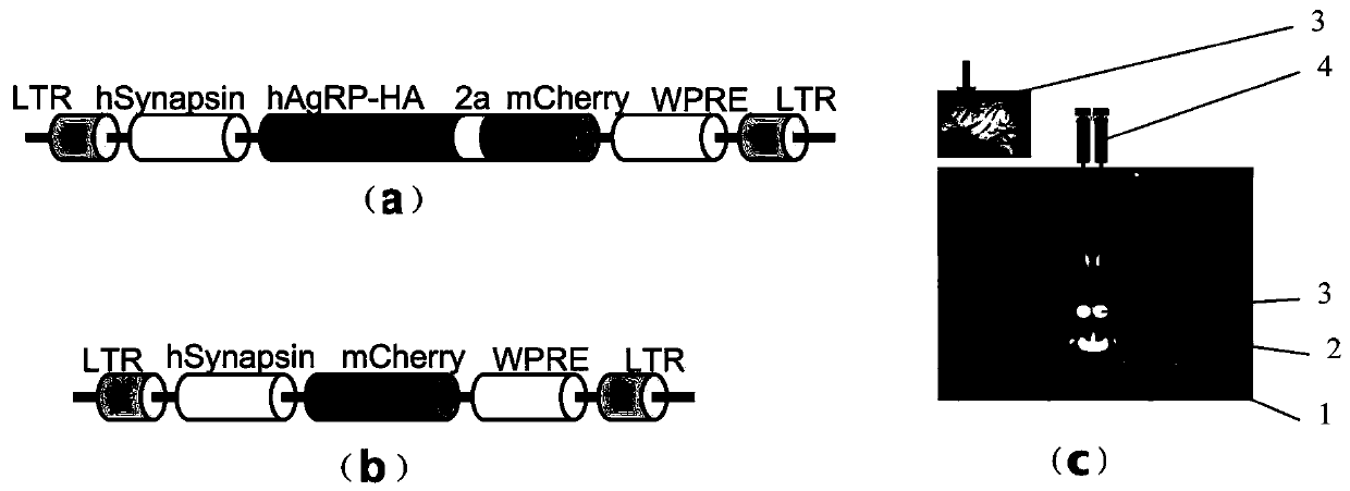 Construction method of gene overexpression chimeric animal model based on hAgRP and application of construction method