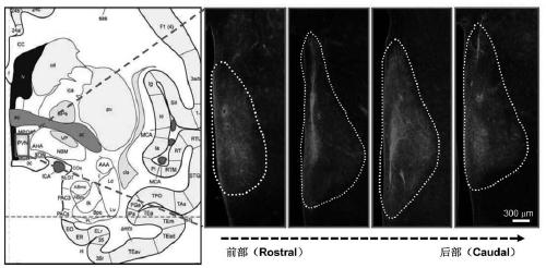 Construction method of gene overexpression chimeric animal model based on hAgRP and application of construction method