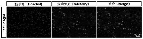 Construction method of gene overexpression chimeric animal model based on hAgRP and application of construction method