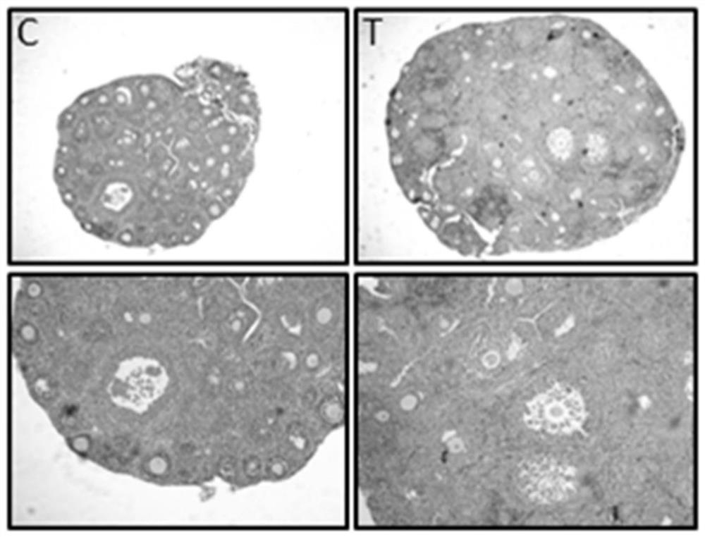 Primordial follicle activator and its application in culture medium of human ovarian cortex