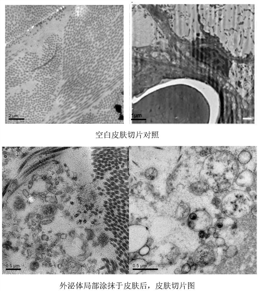 Application of transdermal peptide modified pueraria thomsonii exosome nano preparation in preparation of anti-skin aging products