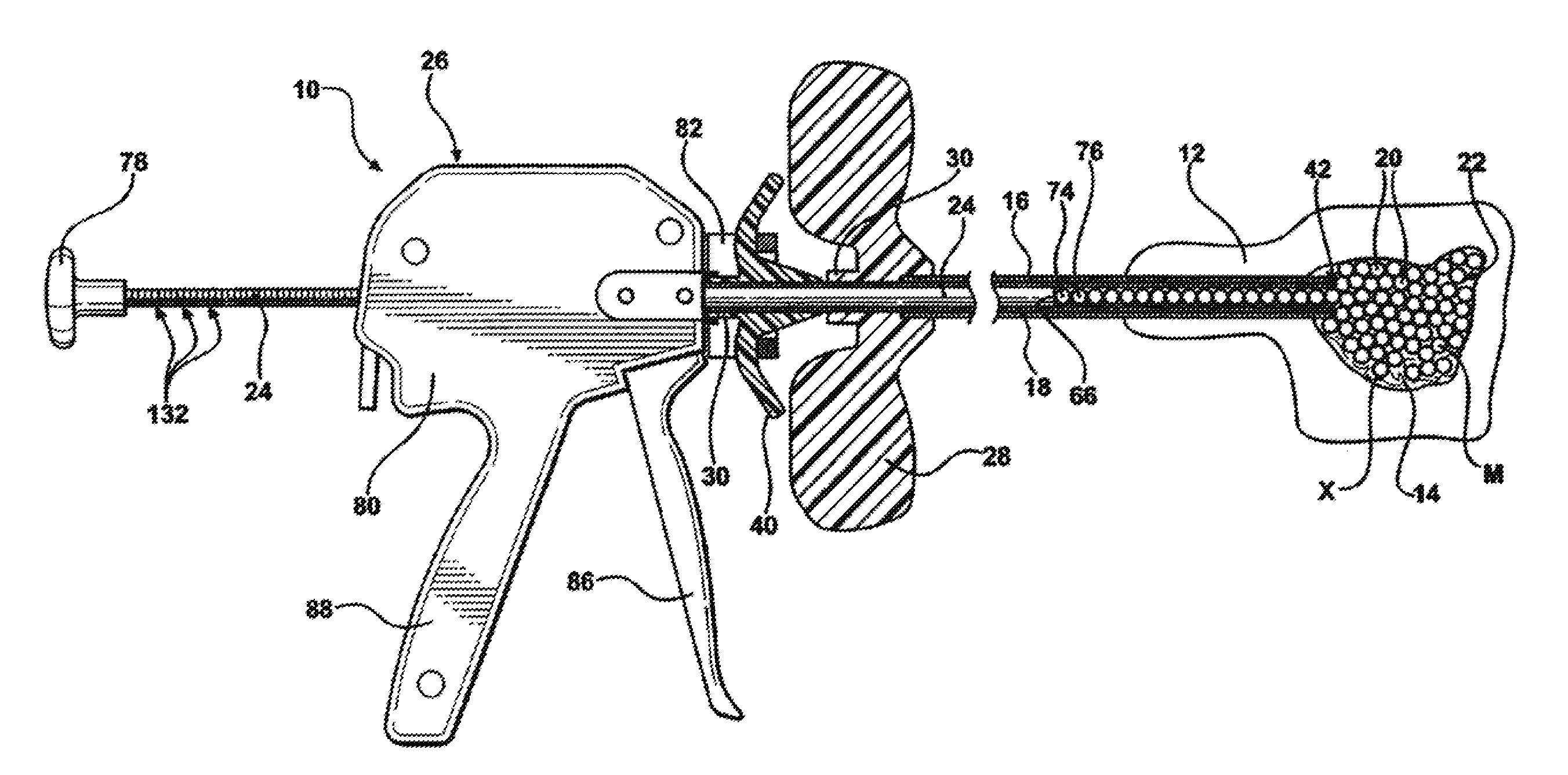 System and method for deliverying an agglomeration of solid beads and cement to the interior of a bone in order to form an implant within the bone