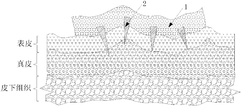 Flexible skin surface dry electrode and preparation method thereof