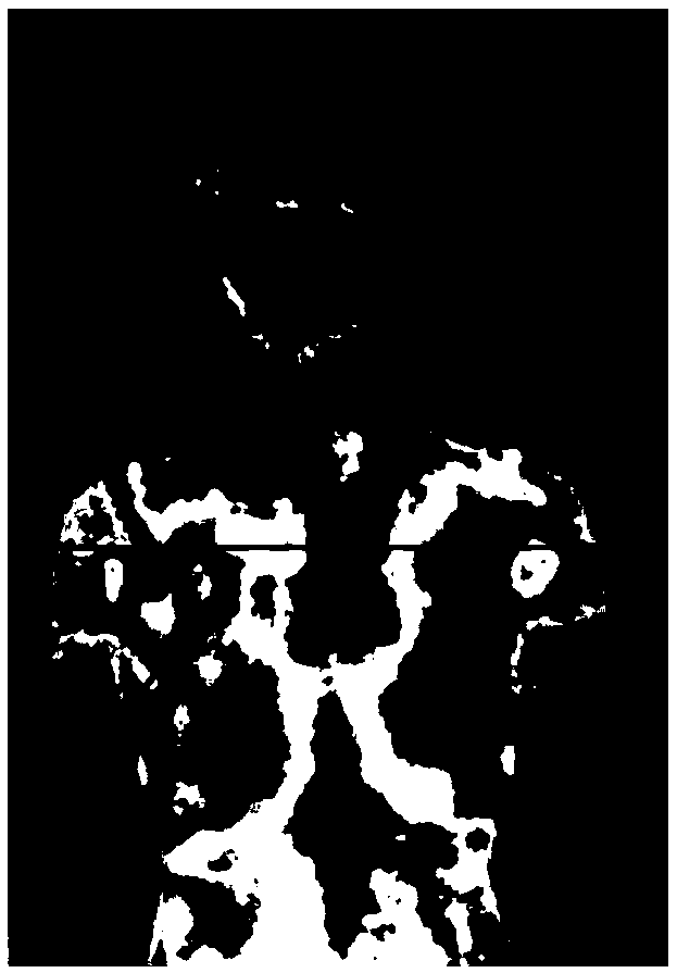 KL divergence-based cervical vertebra thermal imaging data verification method